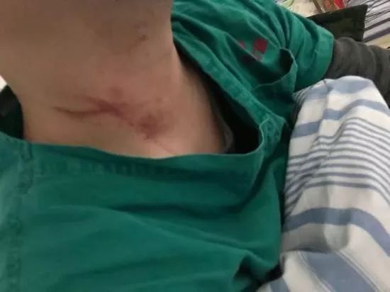 武汉医生被肺炎病人家属殴打，警方：刑事拘留