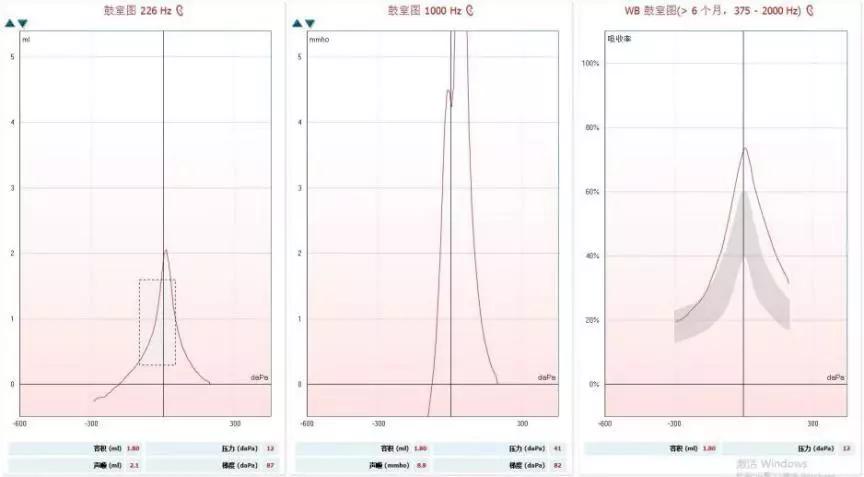宽频声导抗