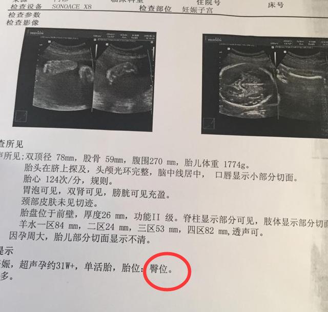几周做心脏彩超最佳 a2cbd486a39e44f3aee6e3c030450bbc.jpeg