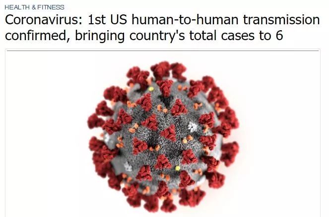 美国病毒现在有多少人口_美国病毒实验室(2)