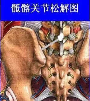 菱形窝.治疗区_腰部