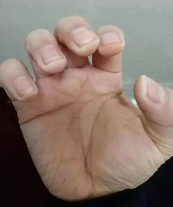 「视听天门」【一线实拍】泪目！抗疫医生和他的孩子们
