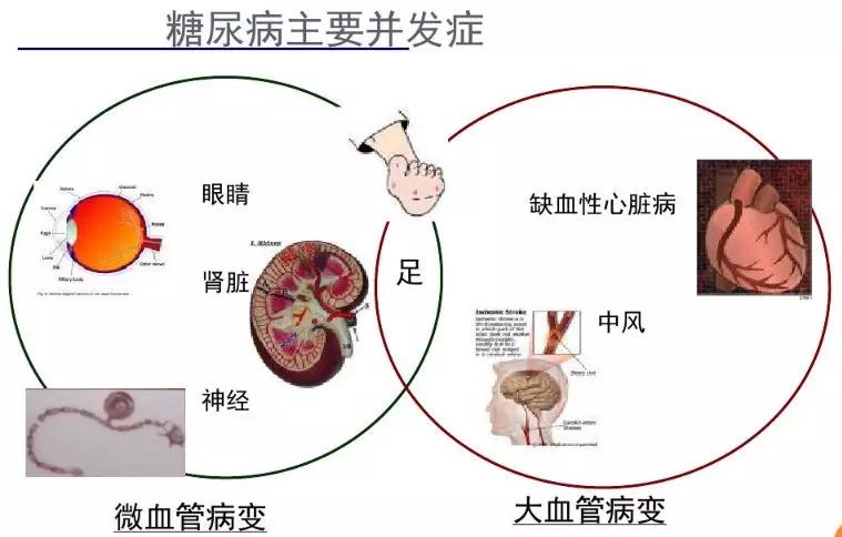 中国人口太多得死一半_1亿人受影响,20万亿楼市蓄势待发 国家突然宣布