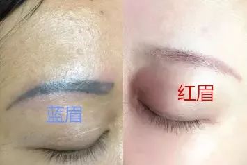 [眉毛出现这两大征兆,一定要改!