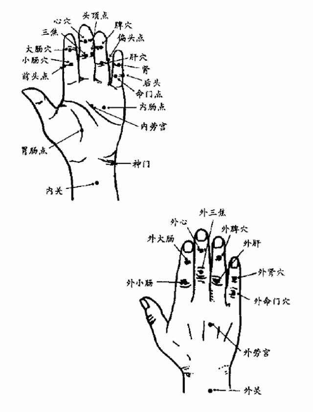 121·取双侧耳压,手穴·取双合谷配双太冲穴·耳穴重点为心,肾穴