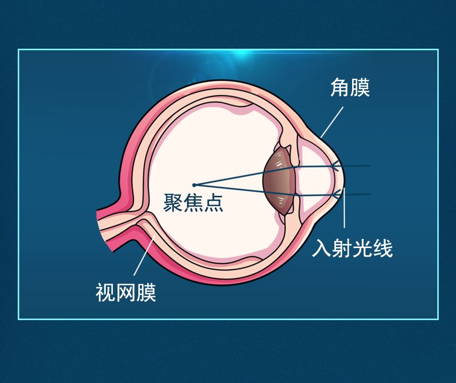 [莹莹育儿]从小忽略这件事，难怪宝宝3岁戴眼镜