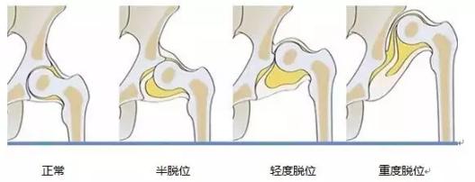 「春龙和宝宝」宝妈告诫：“四个育儿神器，看起来实用其实很坑娃，别瞎花钱了”