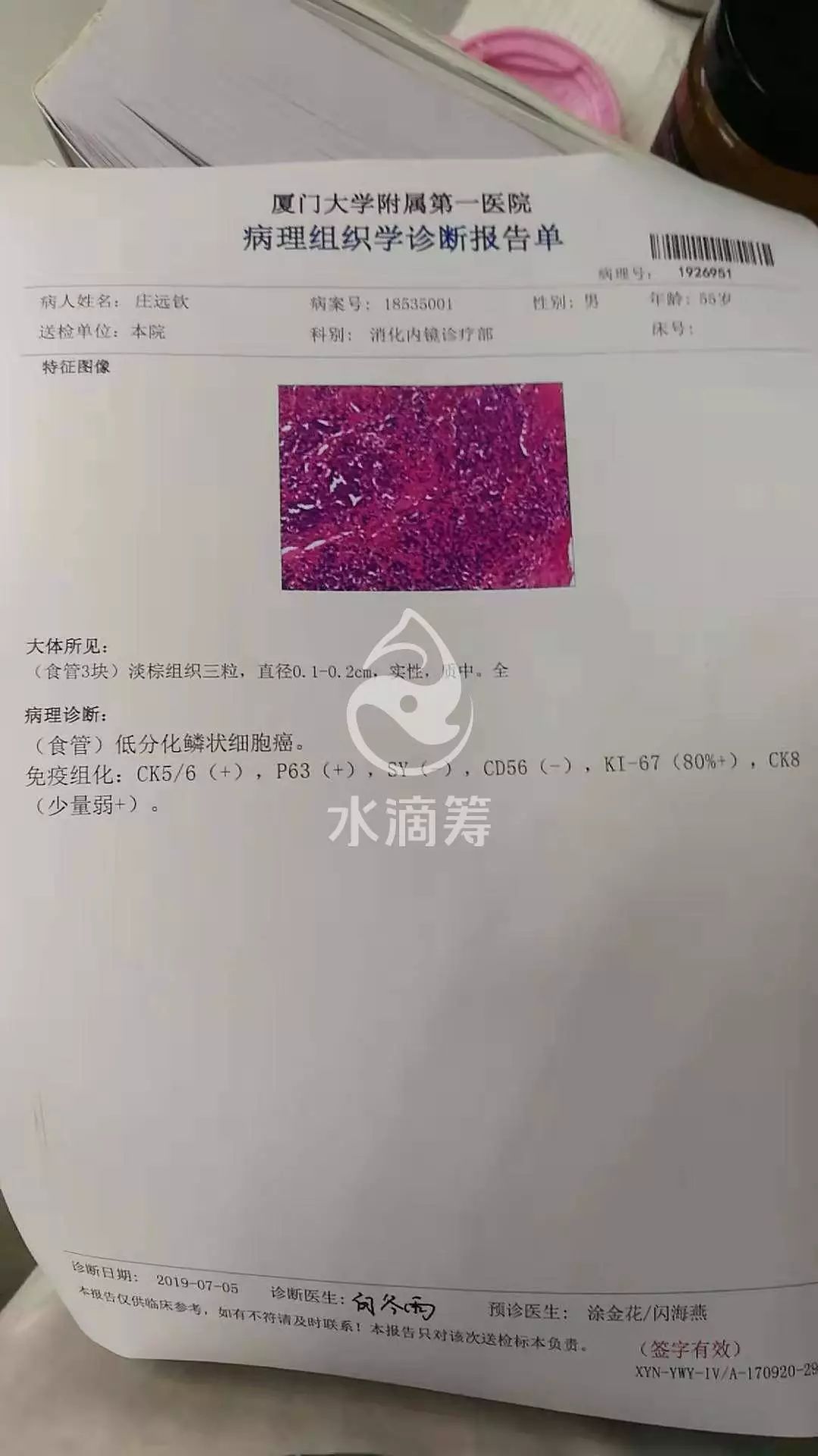 东园:妻子需要长期吃药治疗,如今丈夫突发食管癌,恳请大家帮帮这位