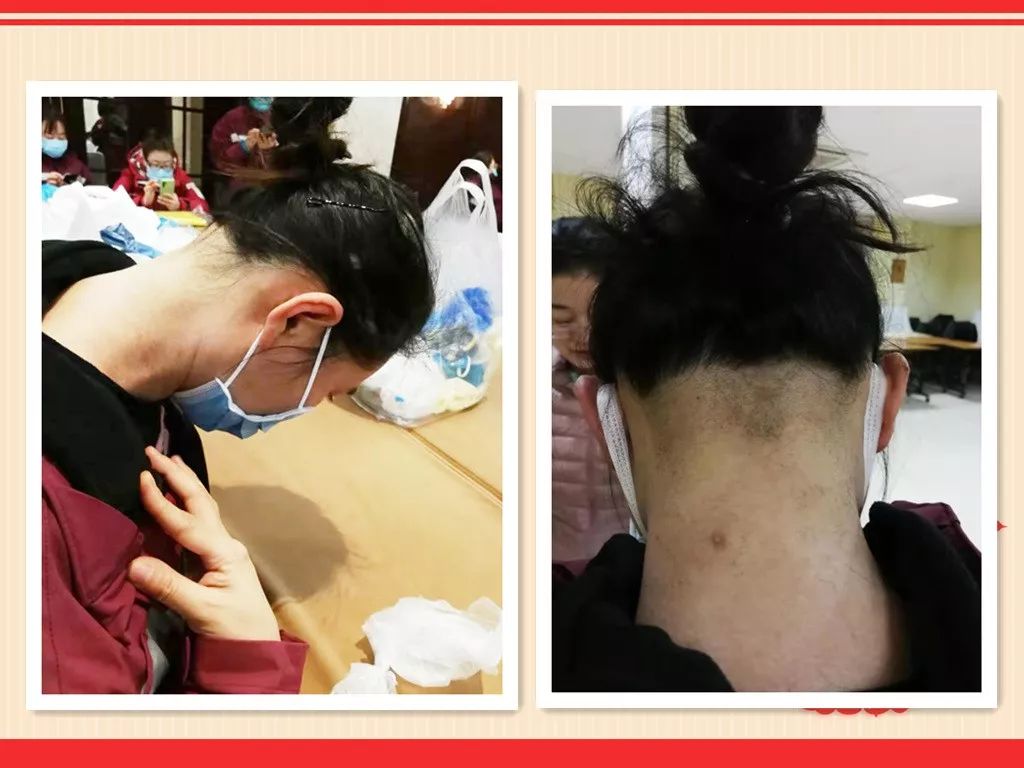 怎么才能保护头发不掉 8b8d20d67b1e45aa9f6080af16aca75e.jpeg