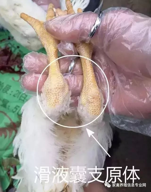 滑液囊反复无常,用药还是往外挑瘦鸡,囊肿关节不好消除?教你一招