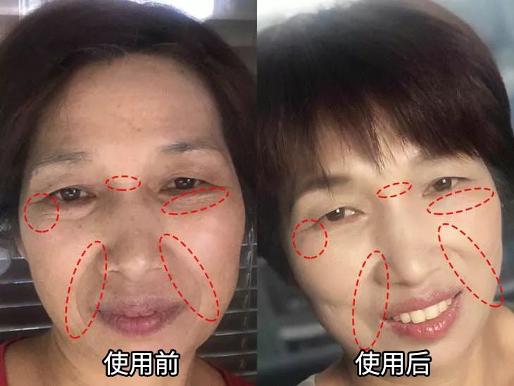 快速祛眼纹最好的方法 c9da5d4d1521408281a3b832e6f762b3.jpeg