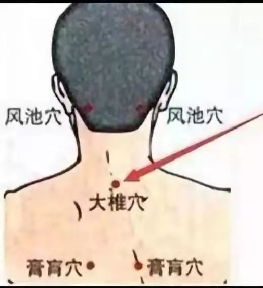 什么体质不适合熏艾 cc2379f4f55a4fa08857704cf436c745.jpeg