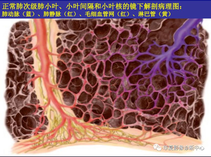 肺间质性疾病的解剖,病理,影像分析