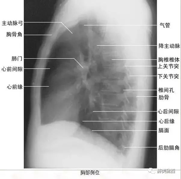 拿到胸片却不会看?送你7个窍门,手把手教你解读胸片(收藏)