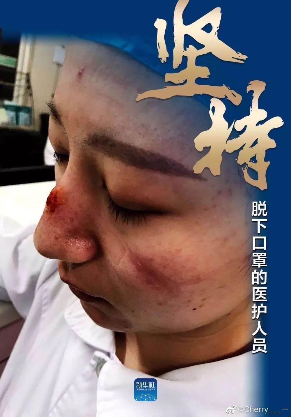 饿金命应该佩戴什么