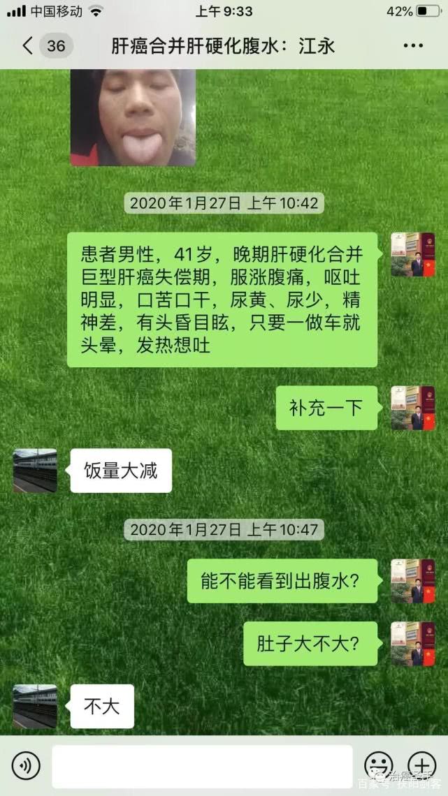 巨型肝癌合并肝硬化癌性腹水临床治疗经验