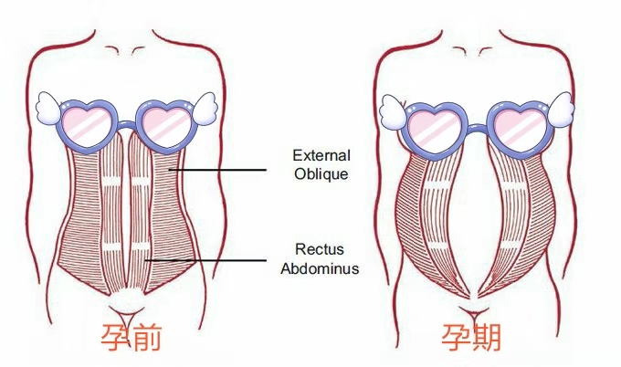 产后坐月子有五大戒律，触碰任意一条，月子等同白坐