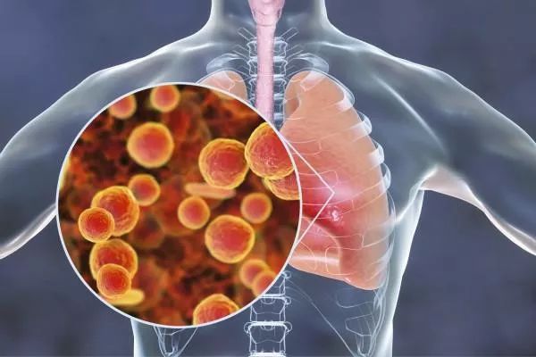 吃什么对肺部好养肺最快 c8cf729b8d1a48f68db136f4b3000fa8.jpeg