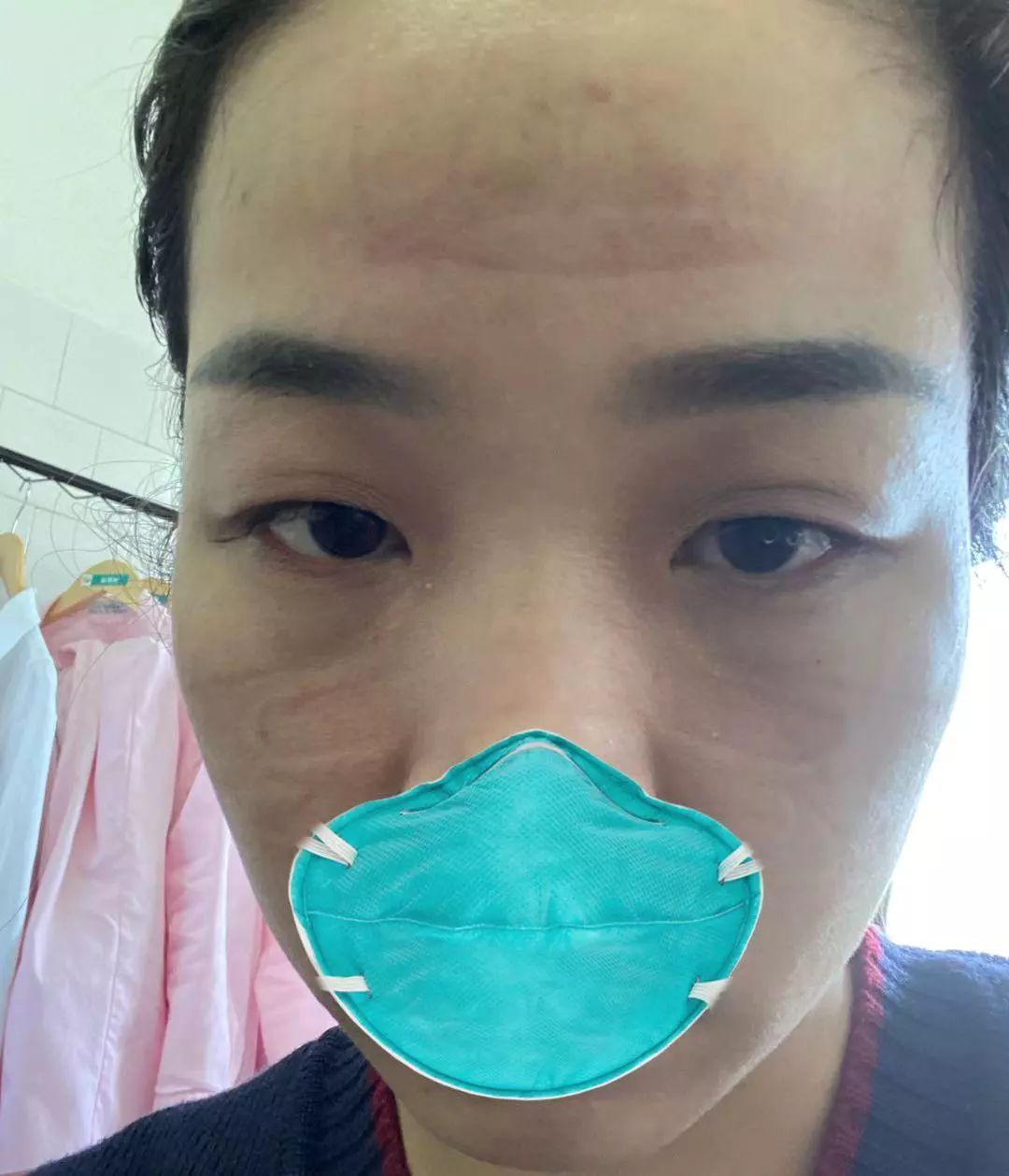 草莓舌是什么样的有图片吗 d2ebb5f6f06c44f5ae8e613d08599c02.png