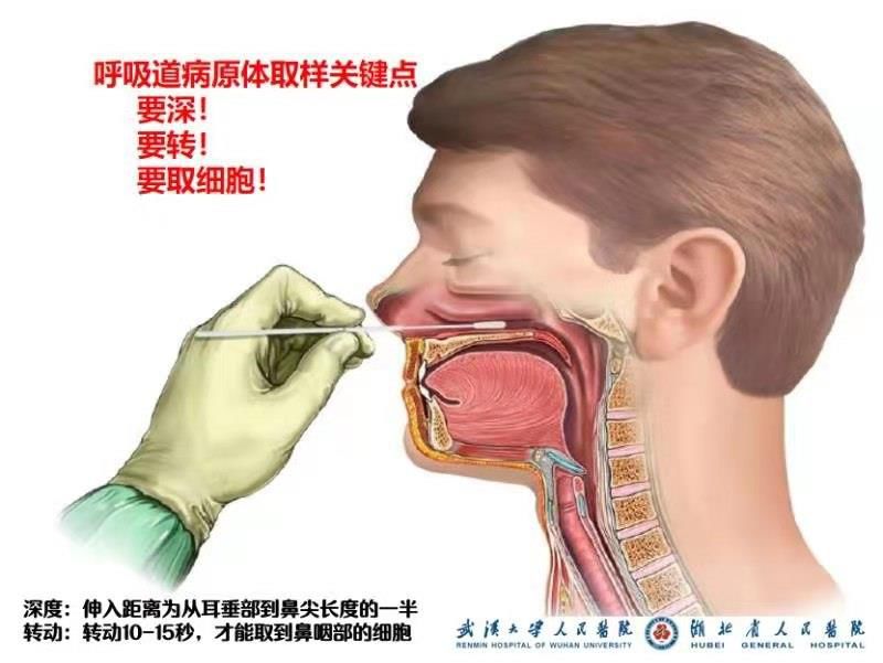 发热门诊日均取咽拭子标本500多例,经验很重要,速来学习