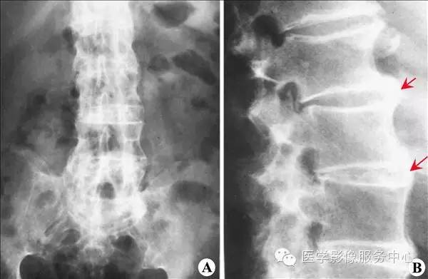 掌握这156种典型病例,骨肌系统影像诊断不用愁