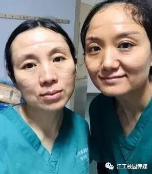 脸上也被口罩勒出了深深的印子.