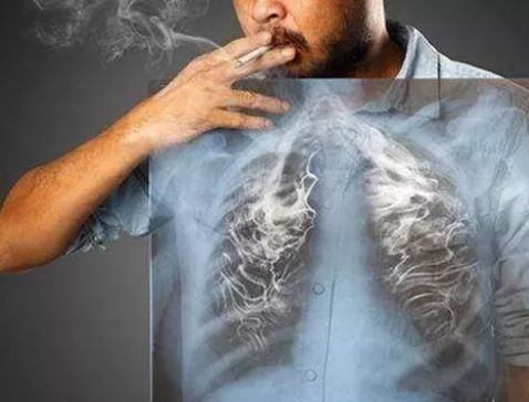 吸烟的人,若不能做到这2运动,也请趁早戒烟,肺癌已虎视眈眈