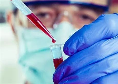 流感并发症死亡率不低，为何我们不恐惧