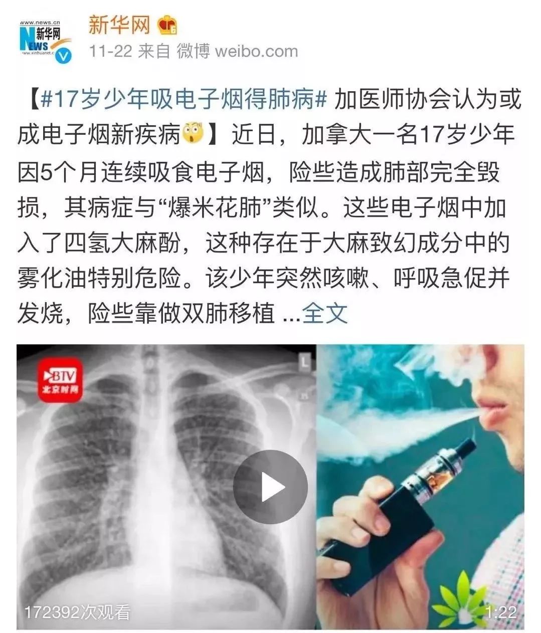 「亲宝宝育儿」这些“网红产品”竟是伤娃利器，你还在给孩子用吗？