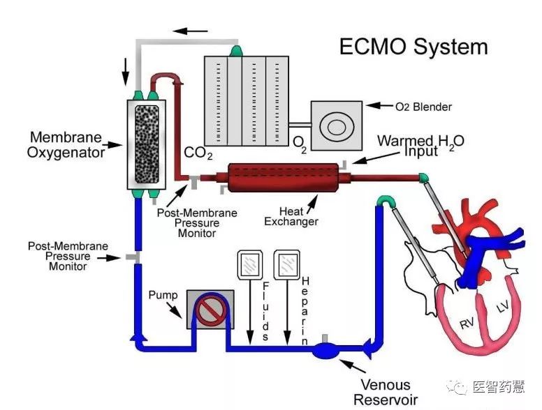 这场疫情中 ecmo 并非第一次使用