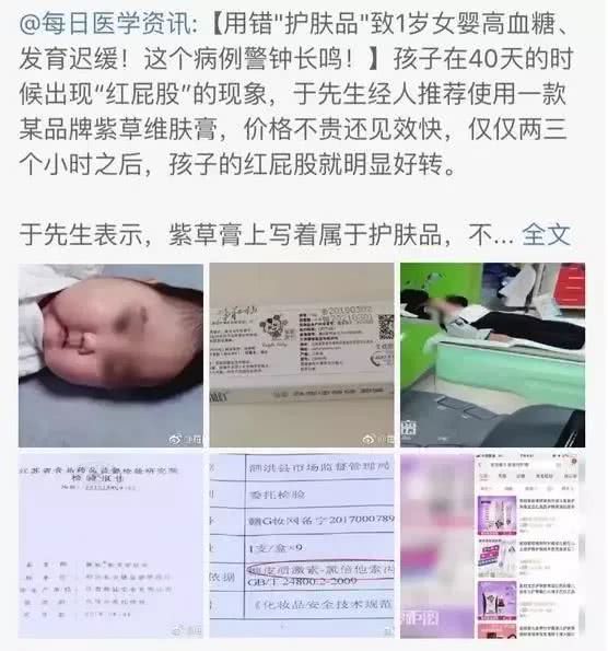 「亲宝宝育儿」这些“网红产品”竟是伤娃利器，你还在给孩子用吗？