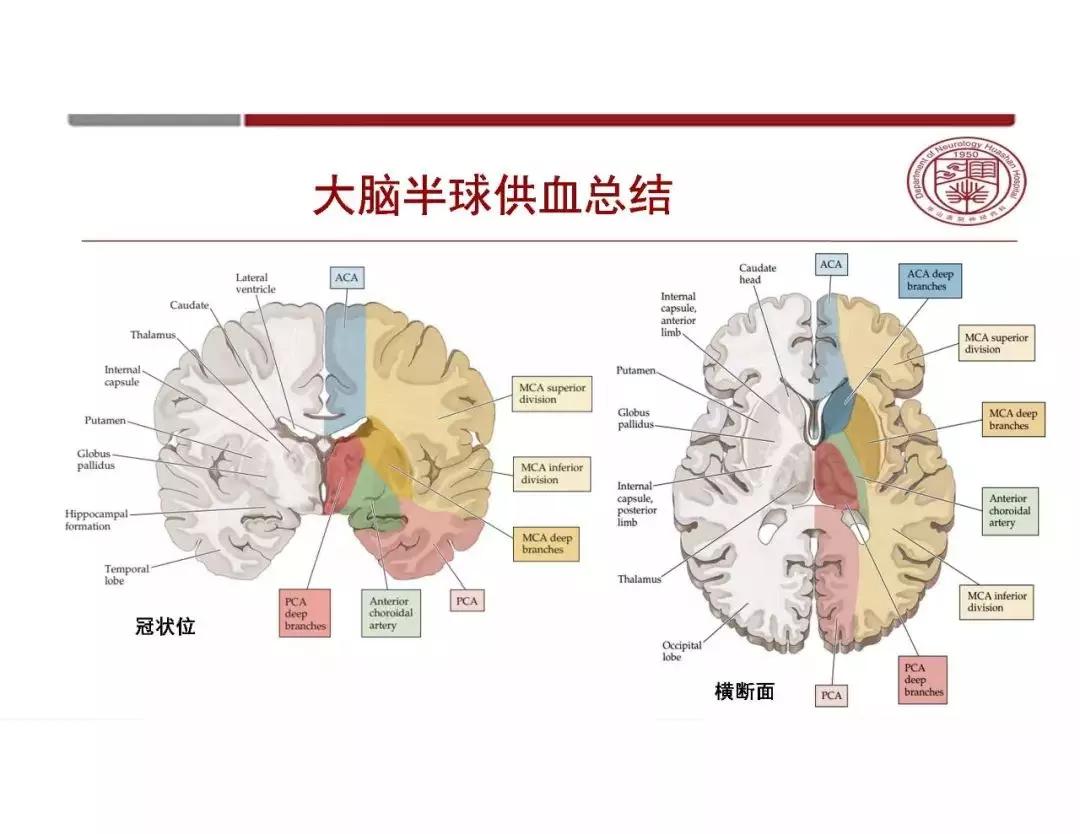 脑血管解剖太复杂?一文教你轻松掌握!