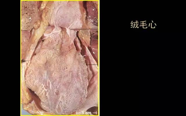 病理学大体标本库