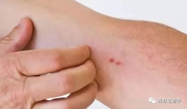 破伤风最早出现的症状多久会出现 0ffb008054c04a709eb817adbac5326f.jpeg