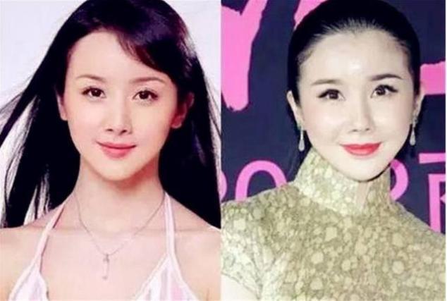 女星整容失败大比拼,本来都是前途无量的明星