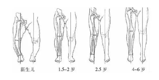小儿推拿分享：宝宝站得太早，会导致腿变弯吗 青岛柔宝健康调理中心
