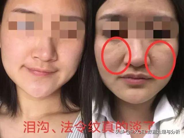 脸怎么变白发亮 940f8b069dcb4c7d9401ade03e3cbb8f.jpeg