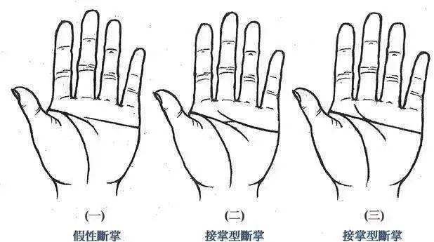 女人断掌纹是什么命 断掌女人命运大反转？被误解千年的手相密码