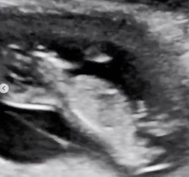 情人节报喜!34岁人气女星结婚一年多突然宣布有喜:已怀孕4个月 情人节报喜!34岁人气女星结婚一年多突然宣布有喜:已怀孕4个月