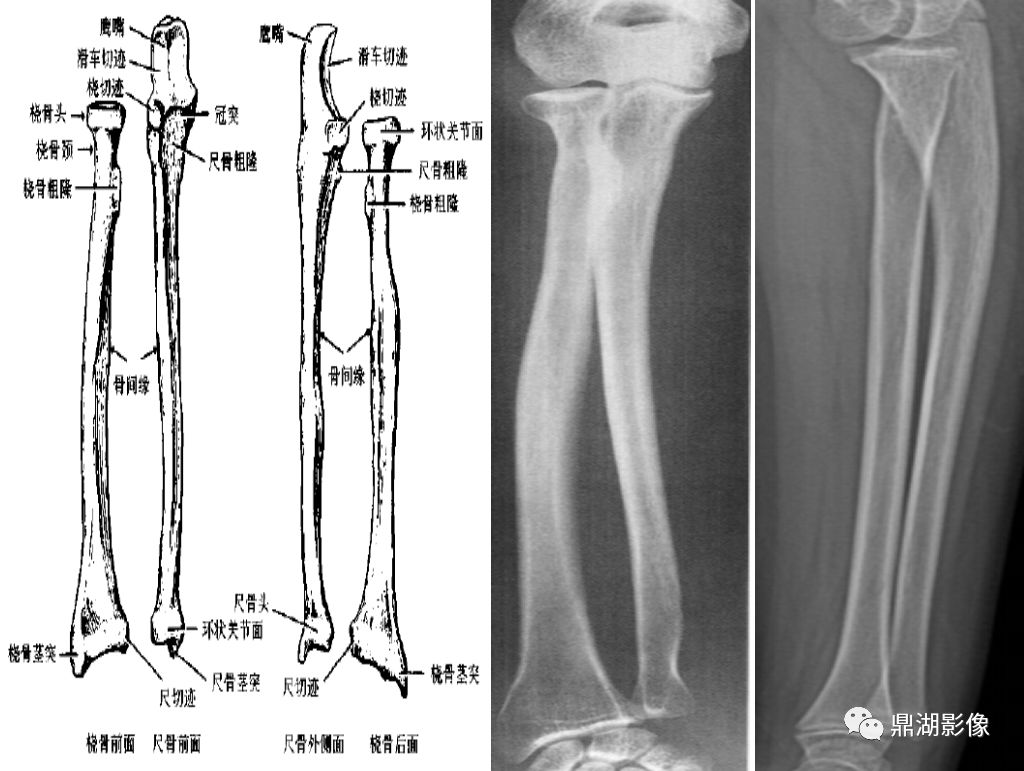 四、四肢骨及其连结-人体解剖学与组织胚胎学-医学