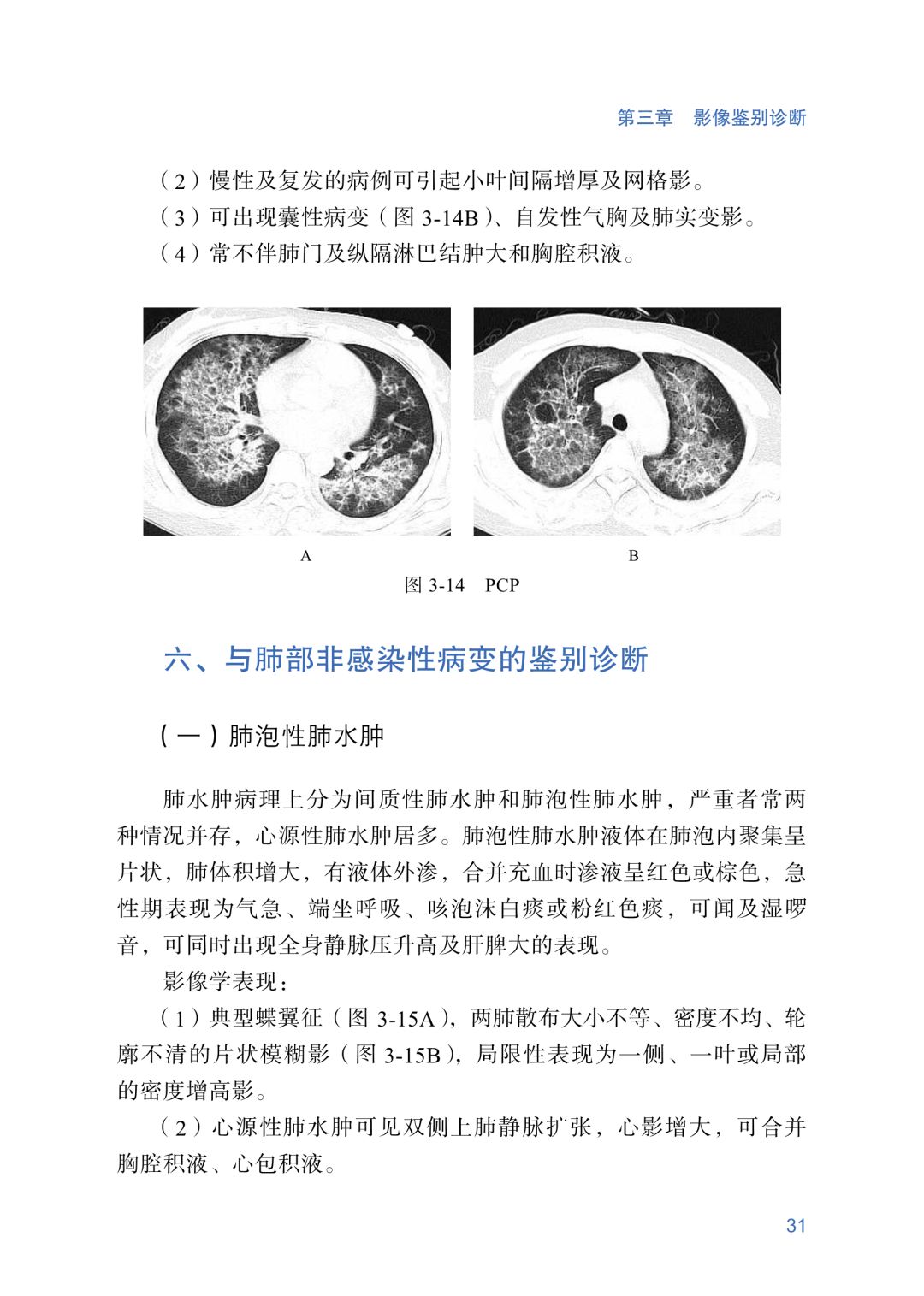 新冠肺炎ct早期征象与鉴别诊断人手一份