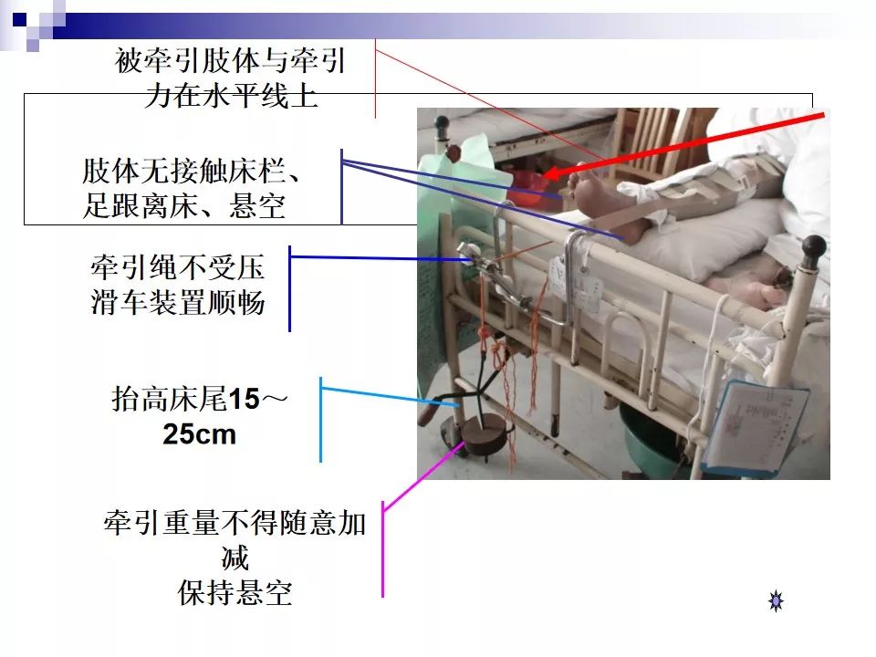 【ppt】皮牵引的护理主题讲座课件(2020)