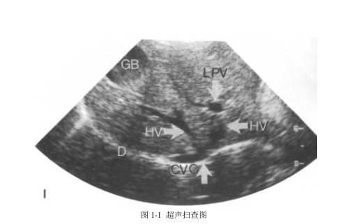 超声成像基础（宠物篇）