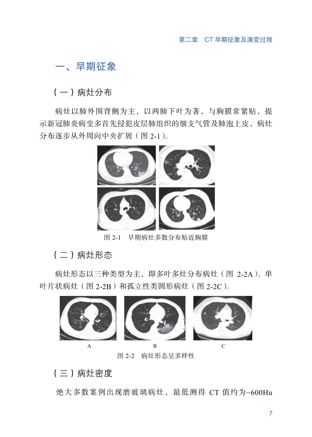 新冠肺炎ct早期征象与鉴别诊断【人手一份】