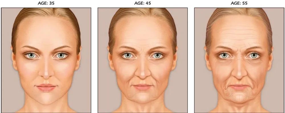 脸的老化松弛下垂，不只是因为胶原蛋白，还有骨骼肌肉以及...