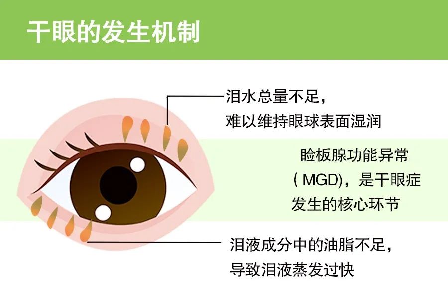 7 | 10秒自测干眼症(超准)!