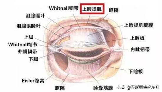 上睑下垂,如果不做提肌只割双眼皮,结果会怎样?