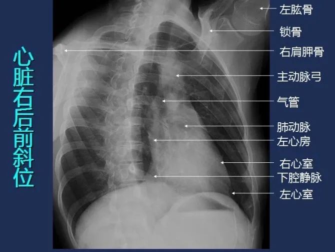 收藏全身x线图谱阅片必备