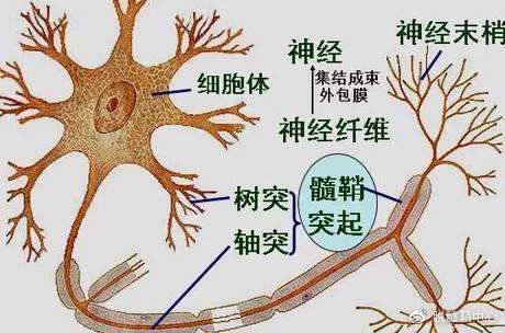 如炎性脱髓鞘;继发性脱髓鞘是由于神经细胞发生病变殃及到髓鞘导致,如