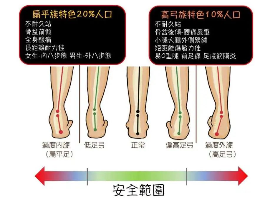 2. 易脚酸,不耐走路-小腿外侧,大腿外侧都因高足弓而变得长期紧绷